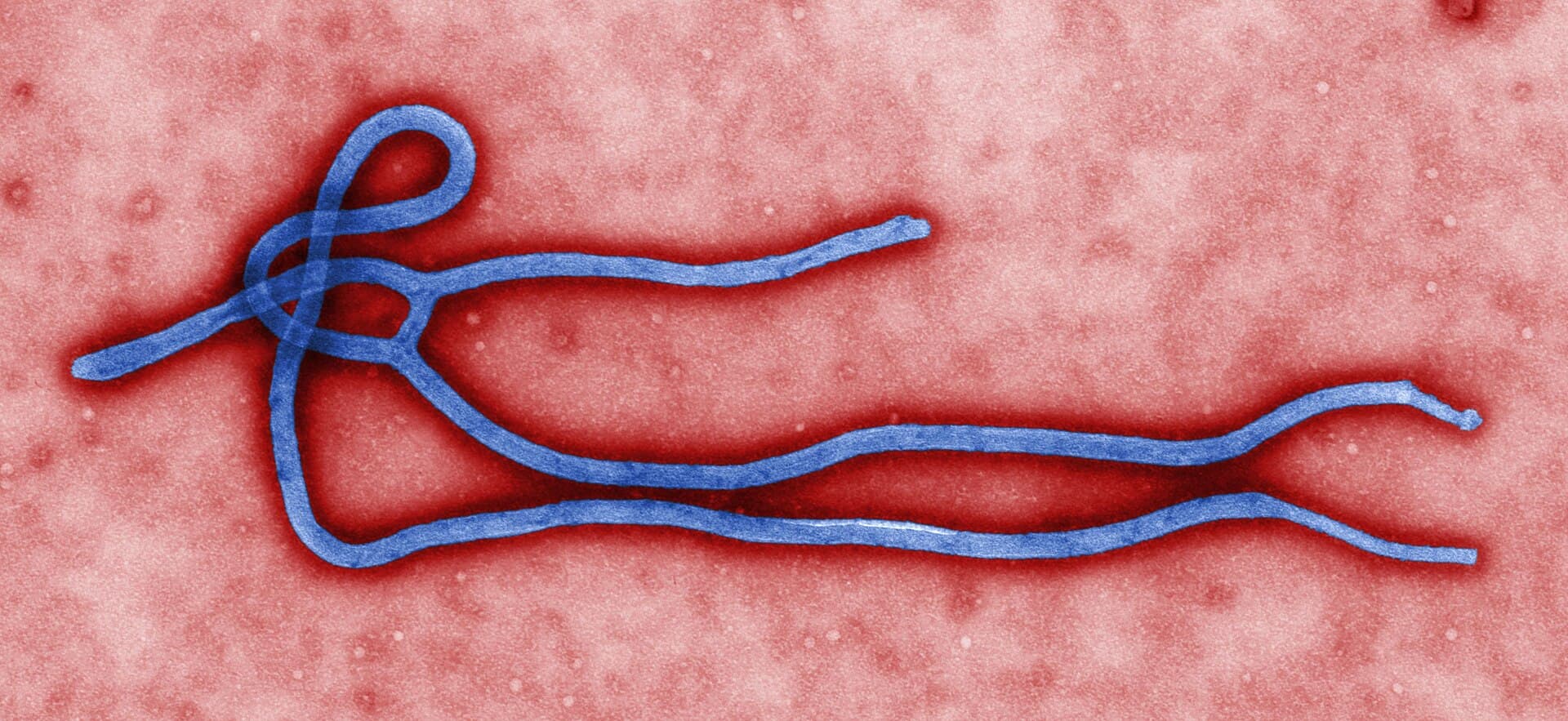 1920px-Ebola_virus_virion.jpg